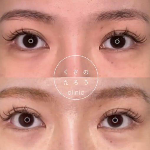 グラマラスライン