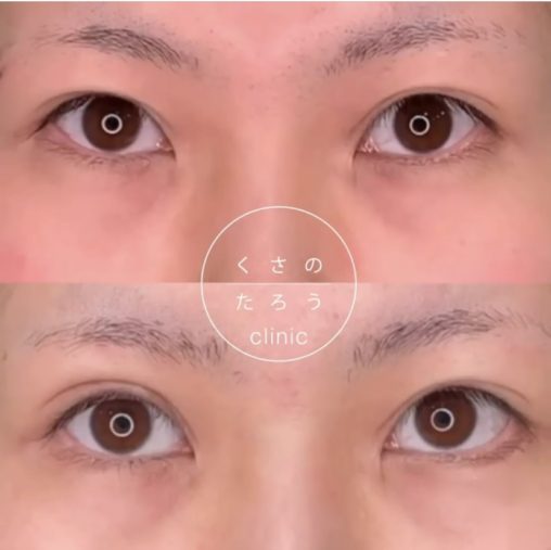 グラマラスライン