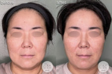 メーラーファット<br />
ジョールファット