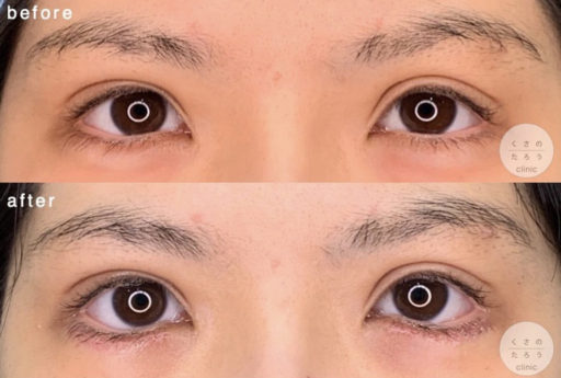 グラマラスライン