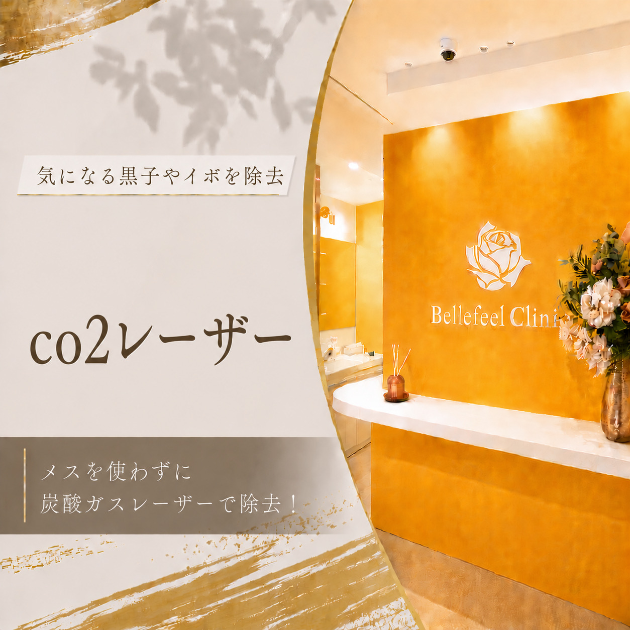 気になる黒子やイボを除去☀️co2レーザー